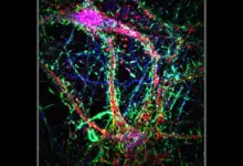 Johns Hopkins identifica nanotubos que espalham Alzheimer, diz estudo