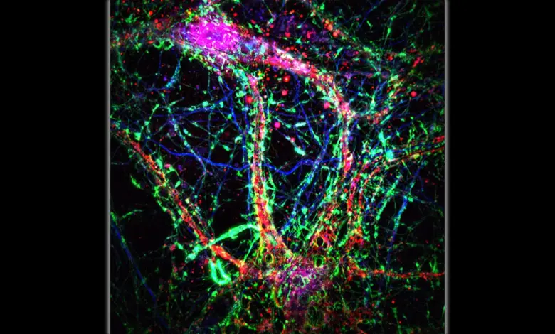 Johns Hopkins identifica nanotubos que espalham Alzheimer, diz estudo
