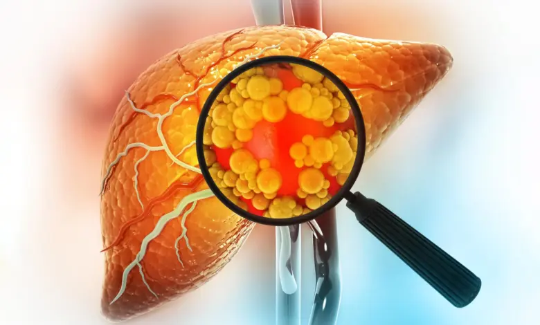 Estudo revela causa real de mortes por doença hepática