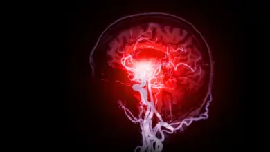 Cientistas identificam lesão cerebral oculta em estudo sobre demência