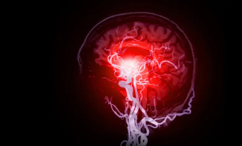 Cientistas identificam lesão cerebral oculta em estudo sobre demência