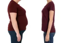 Estudo Cleveland Clinic aponta cirurgia mais eficaz que Ozempic