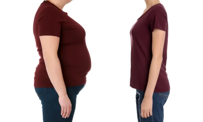 Estudo Cleveland Clinic aponta cirurgia mais eficaz que Ozempic