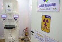 Mulher 40+ sorridente com médico em ambiente hospitalar, aparelho de mamografia no foco.