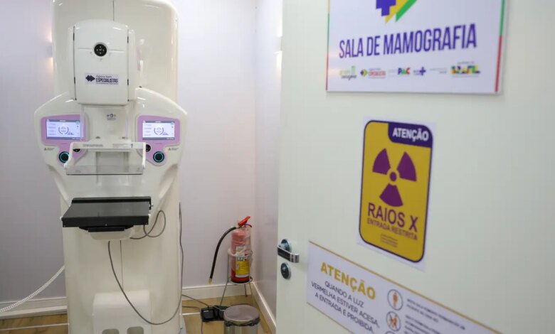 Mulher 40+ sorridente com médico em ambiente hospitalar, aparelho de mamografia no foco.